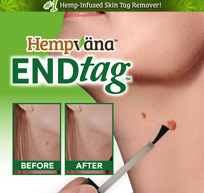 Hempvana End Tag; close up of End Tag being brushed onto skin tag on neck; before and after of skin tag on woman's neck